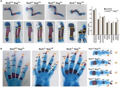 A Novel Role for the BMP Antagonist Noggin in Sensitizing Cells to Non-canonical Wnt-5a/Ror2/Disheveled Pathway Activation